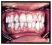 Perodontics and Restoration Dentistry - gum disease